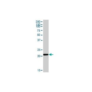 anti-Cytochrome B-245, alpha Polypeptide (CYBA) (Light Chain) antibody avatar