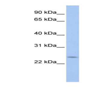 anti-PRELI Domain Containing 2 (PRELID2) (C-Term) antibody avatar