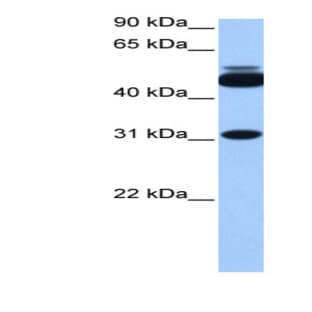 anti-Cylicin, Basic Protein of Sperm Head Cytoskeleton 2 (CYLC2) (C-Term) antibody avatar