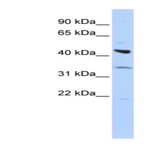 anti-Adrenergic, beta-2-, Receptor, Surface (ADRB2) (Middle Region) antibody avatar