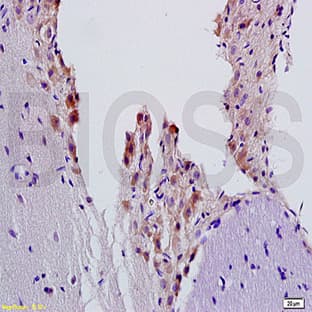 anti-Adrenergic, beta-2-, Receptor, Surface (ADRB2) antibody avatar