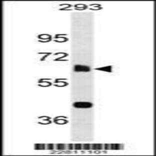 anti-Cytochrome P450, Family 1, Subfamily A, Polypeptide 1 (CYP1A1) (C-Term), (AA 377-405) antibody avatar
