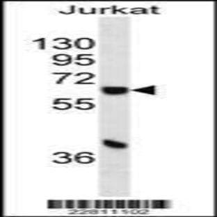 anti-Cytochrome P450, Family 1, Subfamily A, Polypeptide 1 (CYP1A1) (C-Term), (AA 377-405) antibody avatar