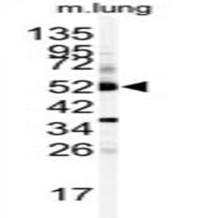 anti-Cytochrome P450, Family 1, Subfamily A, Polypeptide 1 (CYP1A1) (C-Term) antibody avatar