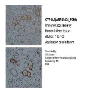 anti-Cytochrome P450, Family 1, Subfamily A, Polypeptide 1 (CYP1A1) (Middle Region) antibody avatar