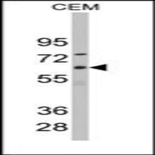 anti-Cytochrome P450, Family 1, Subfamily B, Polypeptide 1 (CYP1B1) (Middle Region) antibody avatar