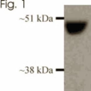 anti-Cytochrome P450, Family 2, Subfamily A, Polypeptide 6 (CYP2A6) antibody avatar