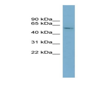 anti-Cytochrome P450, Family 2, Subfamily A, Polypeptide 7 (CYP2A7) (Middle Region) antibody avatar