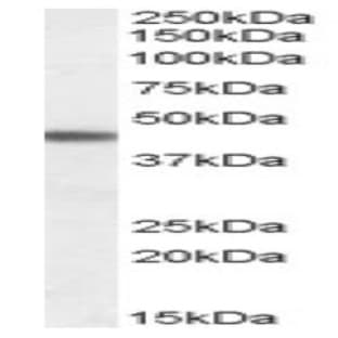 anti-Adrenergic, beta-3-, Receptor (ADRB3) (N-Term) antibody avatar