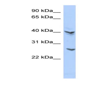 anti-ATPase, H+ Transporting V0 Subunit E2 (ATP6V0E2) (Middle Region) antibody avatar