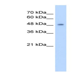 anti-Cytochrome P450, Family 2, Subfamily A, Polypeptide 13 (CYP2A13) (C-Term) antibody avatar