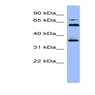 anti-Cytochrome P450, Family 2, Subfamily B, Polypeptide 6 (CYP2B6) (Middle Region) antibody avatar