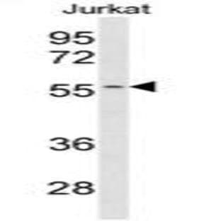 anti-Cytochrome P450, Family 2, Subfamily C, Polypeptide 19 (CYP2C19) (Middle Region) antibody avatar