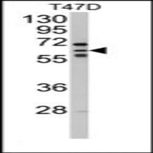 anti-Cytochrome P450, Family 2, Subfamily C, Polypeptide 8 (CYP2C8) (N-Term) antibody avatar