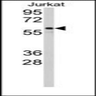 anti-Cytochrome P450, Family 2, Subfamily C, Polypeptide 9 (CYP2C9) (N-Term) antibody avatar