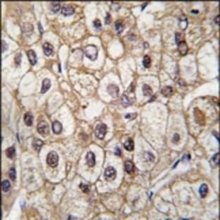 anti-Cytochrome P450, Family 2, Subfamily C, Polypeptide 9 (CYP2C9) (Middle Region) antibody avatar