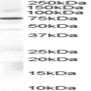 anti-Adrenergic, Beta, Receptor Kinase 1 (ADRB1) (Internal Region) antibody avatar