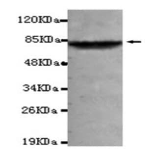 anti-Adrenergic, Beta, Receptor Kinase 1 (ADRB1) (C-Term) antibody avatar