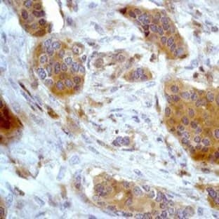 anti-Adrenergic, Beta, Receptor Kinase 1 (ADRB1) (C-Term) antibody avatar