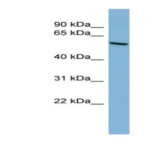 anti-Cytochrome P450, Family 2, Subfamily C, Polypeptide 18 (CYP2C18) (N-Term) antibody avatar