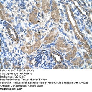 anti-Cytochrome P450, Family 2, Subfamily D, Polypeptide 6 (CYP2D6) (N-Term) antibody avatar