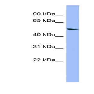 anti-Cytochrome P450, Family 2, Subfamily D, Polypeptide 6 (CYP2D6) (Middle Region) antibody avatar