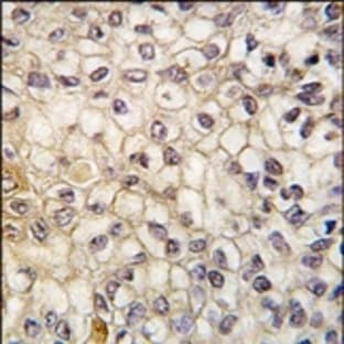 anti-Cytochrome P450, Family 2, Subfamily F, Polypeptide 1 (CYP2F1) (C-Term), (AA 402-432) antibody avatar