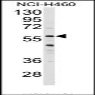 anti-Cytochrome P450, Family 3, Subfamily A, Polypeptide 4 (CYP3A4) (Middle Region) antibody avatar
