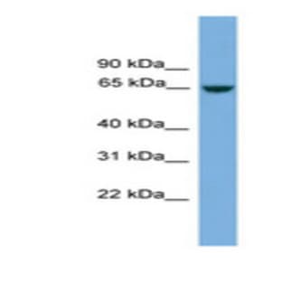 anti-Chromosome 8 Open Reading Frame 45 (C8orf45) (Internal Region) antibody avatar
