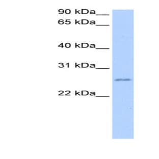 anti-Chromosome 8 Open Reading Frame 84 (C8orf84) (C-Term) antibody avatar