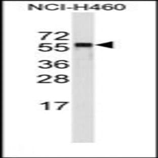 anti-Cytochrome P450, Family 4, Subfamily A, Polypeptide 11 (CYP4A11) (C-Term) antibody avatar