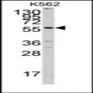 anti-Cytochrome P450, Family 7, Subfamily A, Polypeptide 1 (CYP7A1) (C-Term) antibody avatar