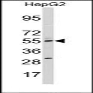 anti-Cytochrome P450, Family 11, Subfamily A, Polypeptide 1 (CYP11A1) (N-Term) antibody avatar