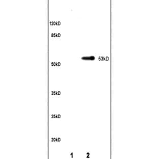 anti-Cytochrome P450, Family 11, Subfamily A, Polypeptide 1 (CYP11A1) antibody avatar