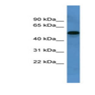 anti-Cytochrome P450, Family 11, Subfamily B, Polypeptide 1 (CYP11B1) (C-Term) antibody avatar