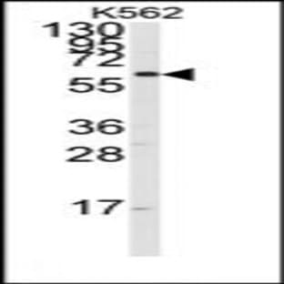 anti-Cytochrome P450, Family 17, Subfamily A, Polypeptide 1 (CYP17A1) (Middle Region) antibody avatar