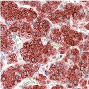 anti-Cytochrome P450, Family 17, Subfamily A, Polypeptide 1 (CYP17A1) (Internal Region) antibody avatar