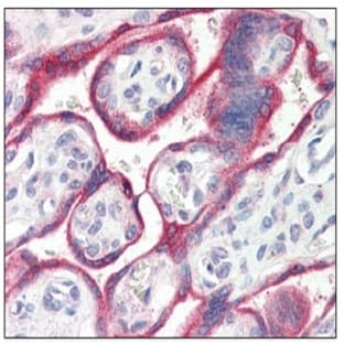 anti-Cytochrome P450, Family 19, Subfamily A, Polypeptide 1 (CYP19A1) (Internal Region) antibody avatar