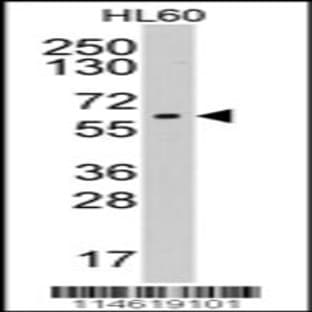 anti-Cytochrome P450, Family 19, Subfamily A, Polypeptide 1 (CYP19A1) (AA 221-253), (Center) antibody avatar