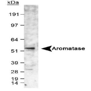 anti-Cytochrome P450, Family 19, Subfamily A, Polypeptide 1 (CYP19A1) (C-Term), (AA 400-502) antibody avatar