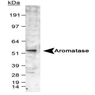 anti-Cytochrome P450, Family 19, Subfamily A, Polypeptide 1 (CYP19A1) (C-Term), (AA 400-502) antibody avatar