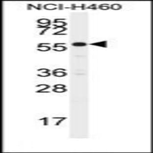 anti-Cytochrome P450, Family 21, Subfamily A, Polypeptide 2 (CYP21A2) (N-Term), (AA 66-95) antibody avatar