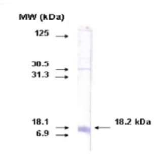 anti-Cytochrome P450, Family 26, Subfamily A, Polypeptide 1 (CYP26A1) (C-Term) antibody avatar