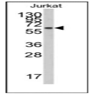 anti-Cytochrome P450, Family 26, Subfamily A, Polypeptide 1 (CYP26A1) (Center) antibody avatar