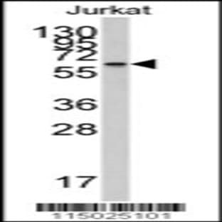 anti-Cytochrome P450, Family 26, Subfamily A, Polypeptide 1 (CYP26A1) (AA 118-147), (Center) antibody avatar