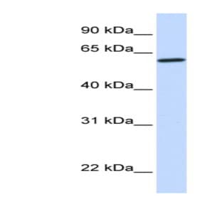 anti-Cytochrome P450, Family 27, Subfamily A, Polypeptide 1 (CYP27A1) (Middle Region) antibody avatar