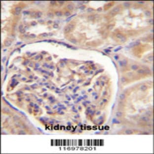 anti-Cytochrome P450, Family 27, Subfamily B, Polypeptide 1 (CYP27B1) (C-Term), (AA 482-508) antibody avatar