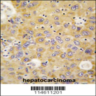 anti-AARS (N-Term), (AA 61-91) antibody avatar