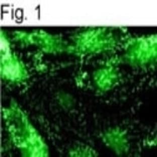 anti-Adaptor-Related Protein Complex 2, alpha 1 Subunit (AP2A1) antibody avatar