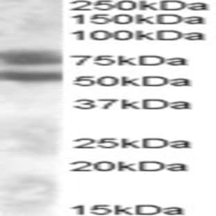 anti-Dachshund Homolog 1 (Drosophila) (DACH1) (Internal Region) antibody avatar
